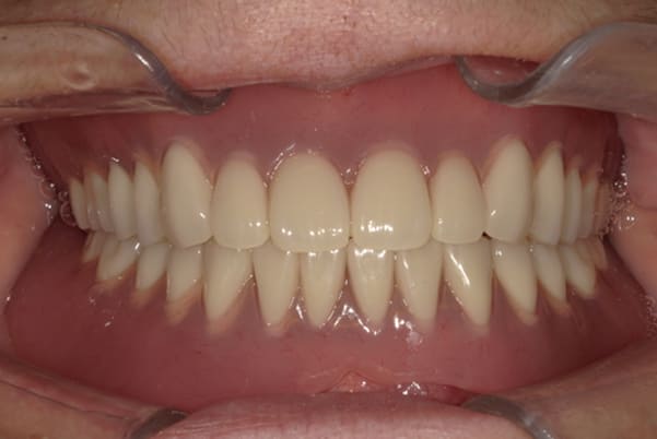 食事ができるようになりたい治療後