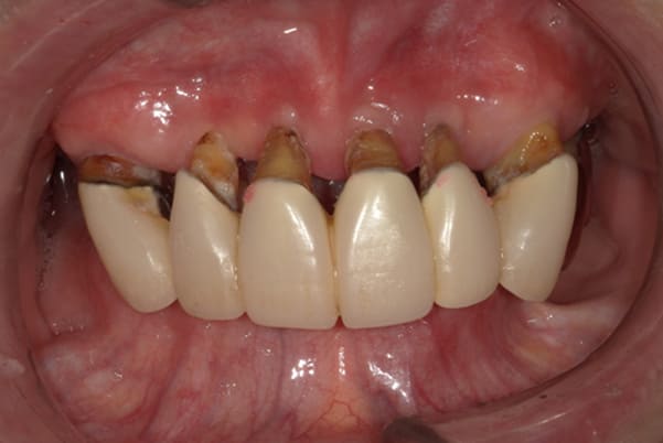 食事ができるようになりたい治療前