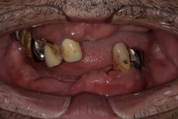 娘とハンバーガーを食べたい治療前