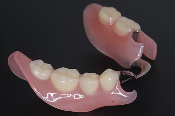 下顎の部分入れ歯1