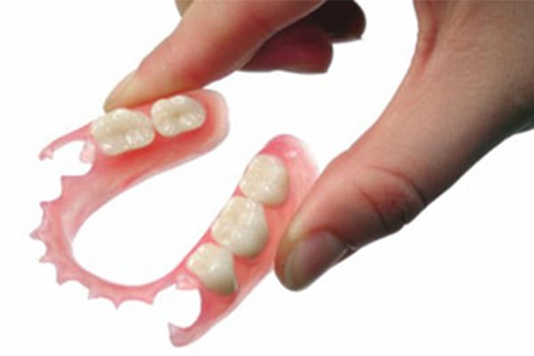 ノンクラスプデンチャー